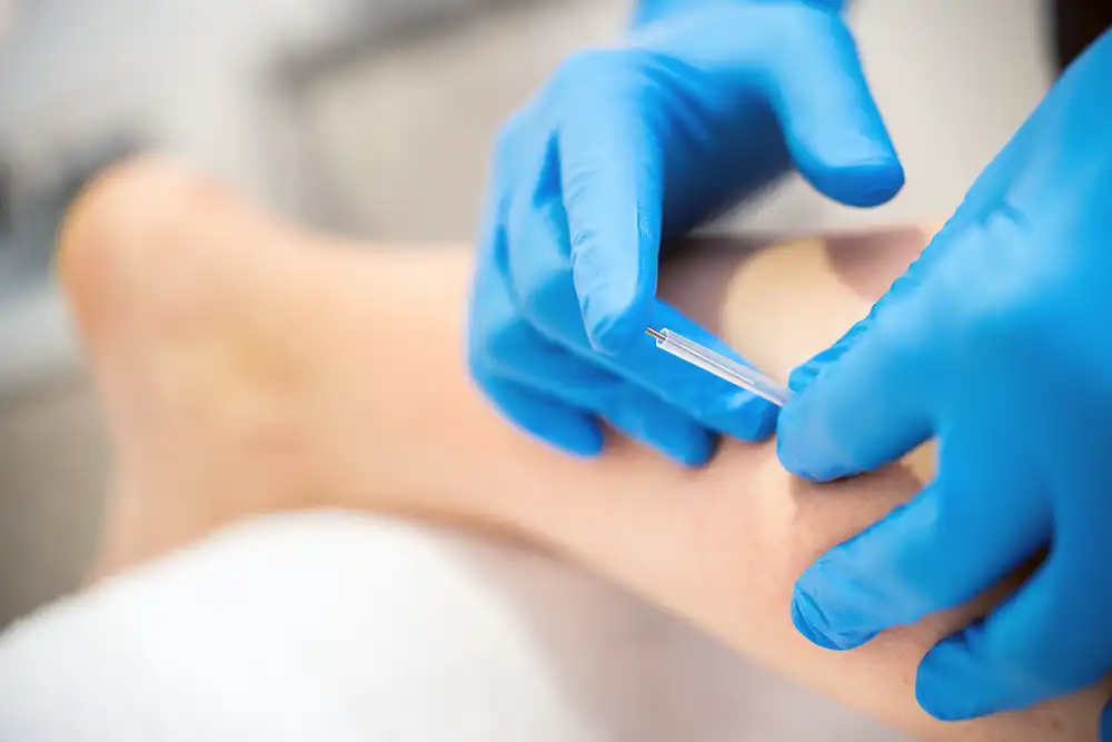 Dry Needling